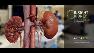 INSIGHT KIDNEY